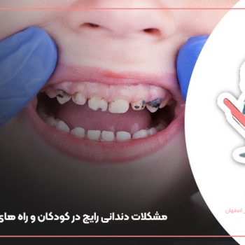 مشکلات دندانی رایج در کودکان