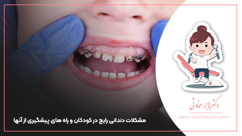 مشکلات دندانی رایج در کودکان