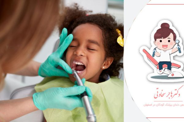تاثیر فلوراید در بهداشت دندان کودکان