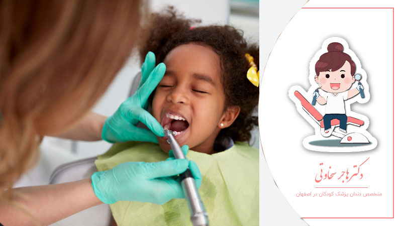 تاثیر فلوراید در بهداشت دندان کودکان