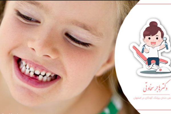 دندان های شیری کودکان کی میافتد؟