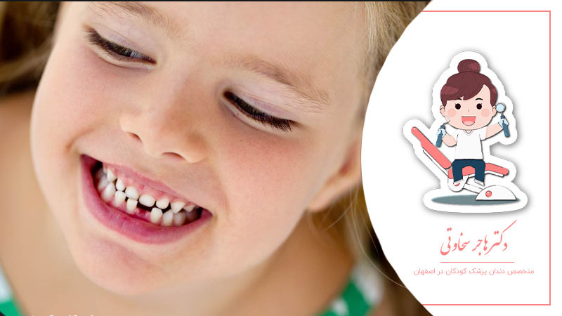دندان های شیری کودکان کی میافتد؟