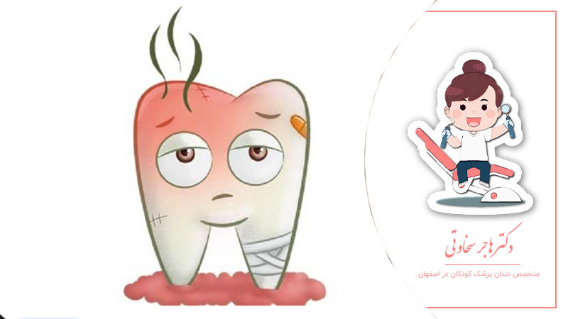  مقایسه کشیدن و عصب کشی دندان شیری