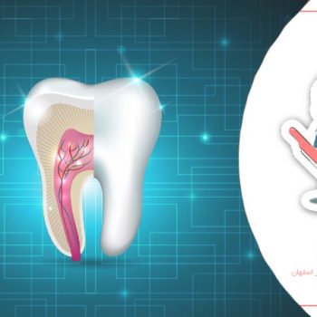 کانال دندان چیست