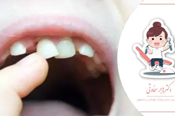 آیا کشیدن دندان شیری دردناک است