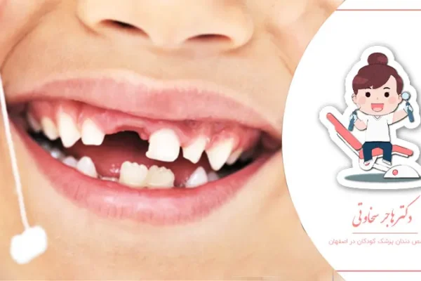 نکات طلایی برای مراقبت از دندان‌های شیری