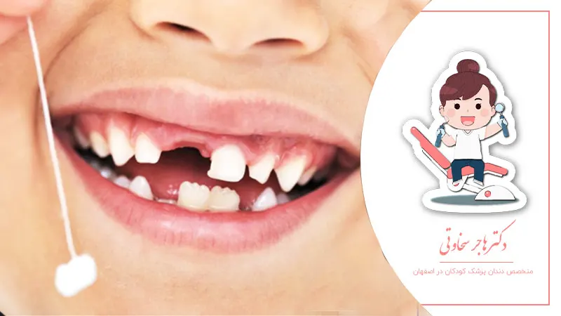 نکات طلایی برای مراقبت از دندانهای شیری