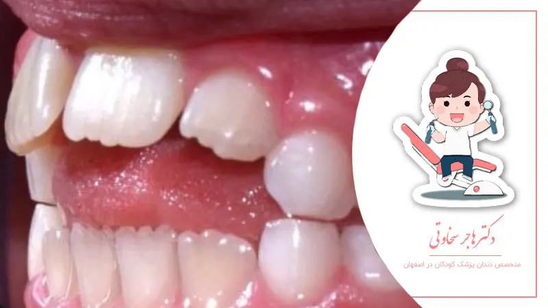 تأثیر عادات غلط بر رشد فک و دندان