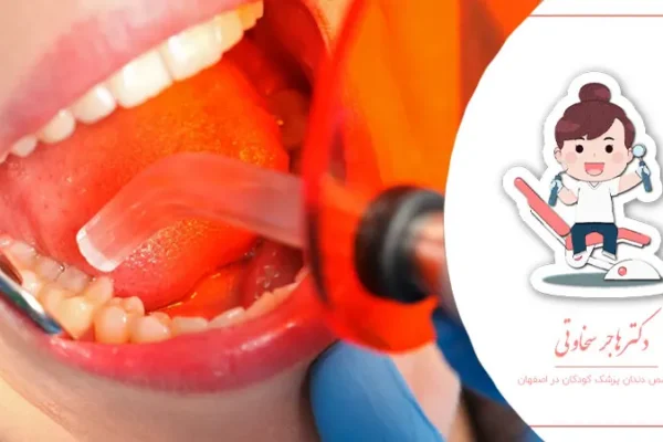 روش‌های نوین ترمیم دندان‌های شیری