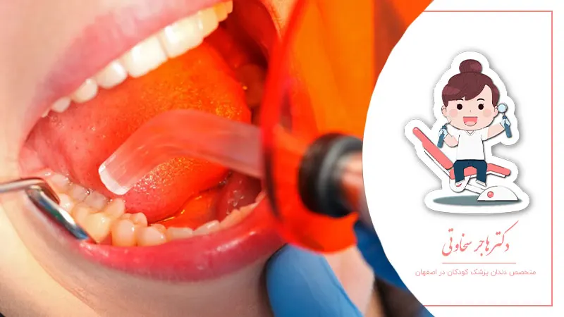 روشهای نوین ترمیم دندانهای شیری