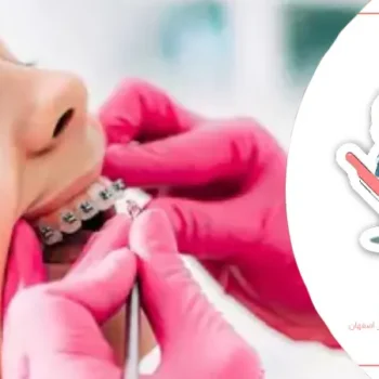 مراقبت از دستگاه‌های ارتودنسی در کودکان