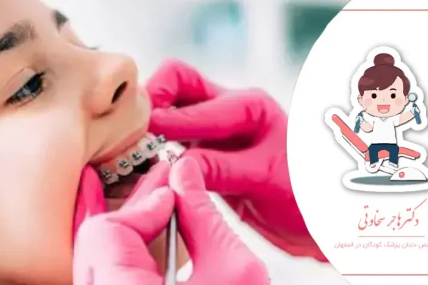 مراقبت از دستگاه‌های ارتودنسی در کودکان