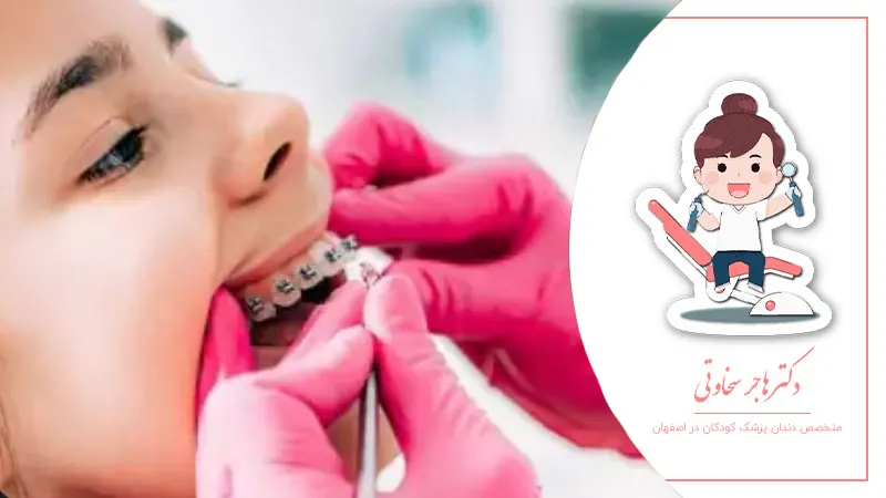 مراقبت از دستگاه‌های ارتودنسی در کودکان