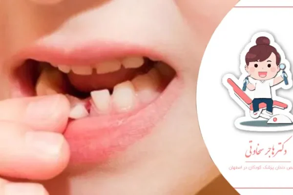 آیا دندان‌های شیری هم نیاز به مراقبت دارند؟