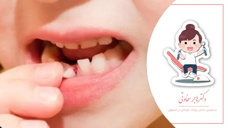 آیا دندان‌های شیری هم نیاز به مراقبت دارند؟