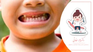 چگونه بهترین دندانپزشک برای کودک خود انتخاب کنیم؟