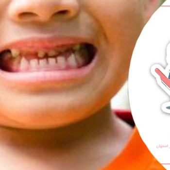 چگونه بهترین دندانپزشک برای کودک خود انتخاب کنیم؟