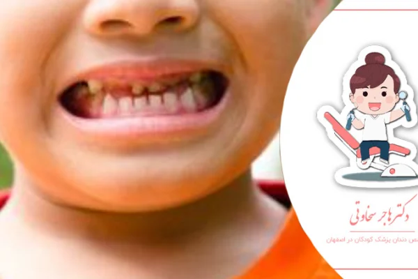 چگونه بهترین دندانپزشک برای کودک خود انتخاب کنیم؟
