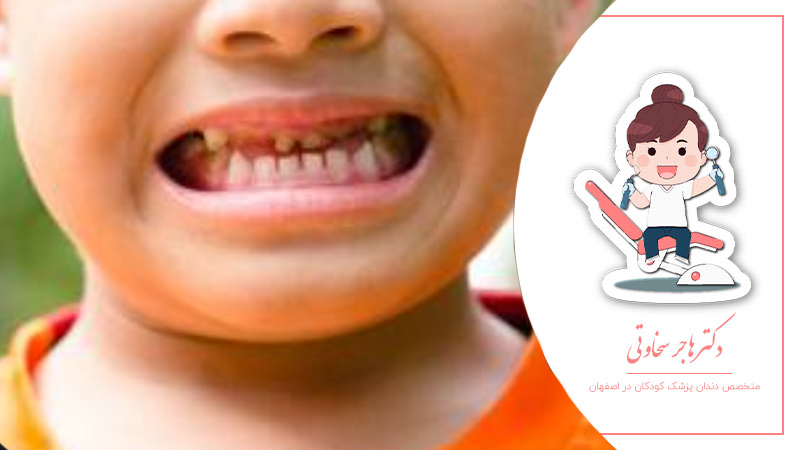 چگونه بهترین دندانپزشک برای کودک خود انتخاب کنیم؟