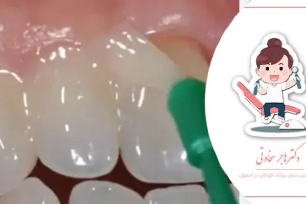 تاثیر مواد فلورایددار بر سلامت دهان کودک